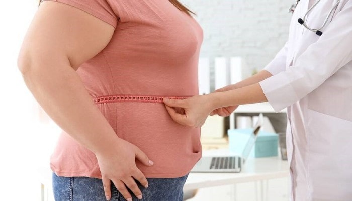 Bariatric Surgery Candidate