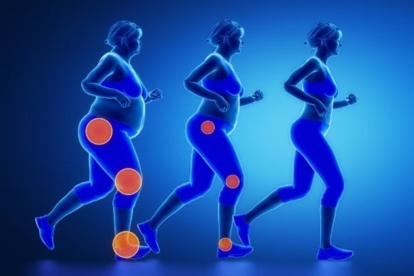 Before or after knee replacement