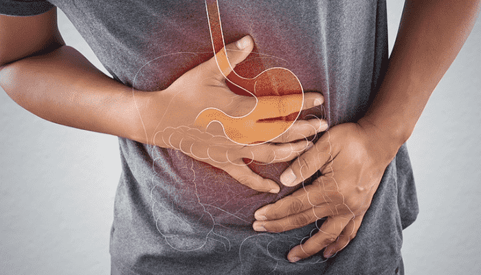 Discovering Relief: Fundoplication Surgery Explained
