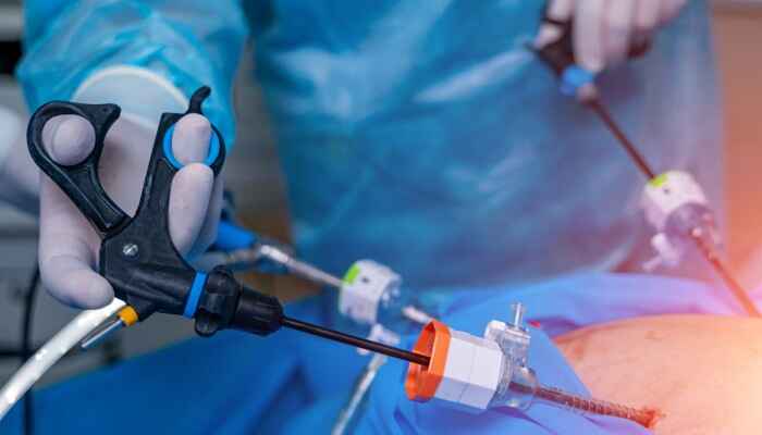 Metabolic Surgery: A Game Changer in the Fight Against Obesity and Related Diseases