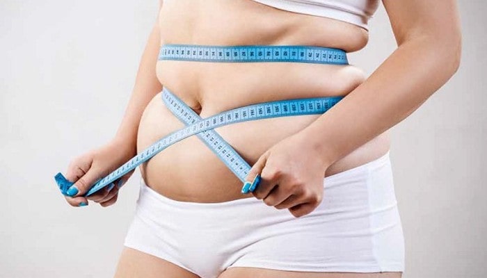 Weight Loss Surgery